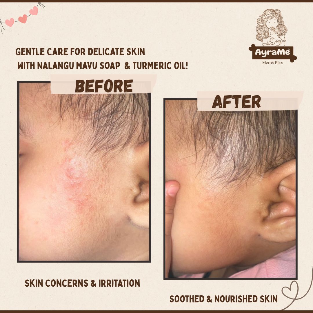 Turmeric Baby Massage Oil - 100ml